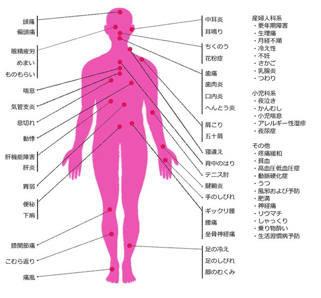 鍼が適応する主な症状